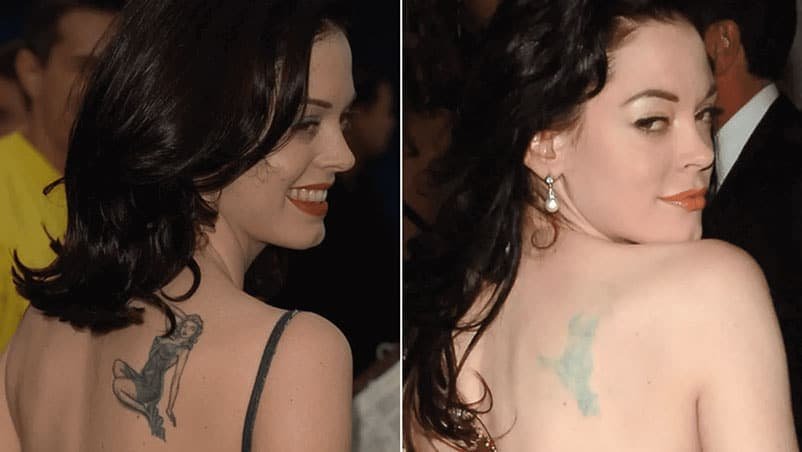 19 Celebrity Tattoo Removal Before and After - TND