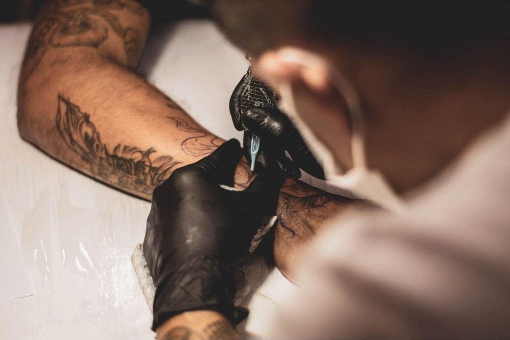Tattoo Removal Procedure