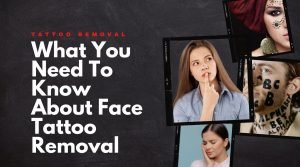face tattoo removal