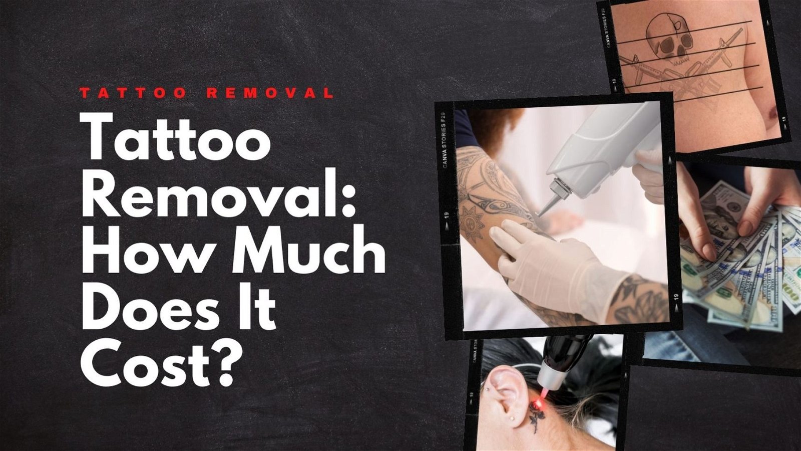 how much does it cost to remove a tattoo